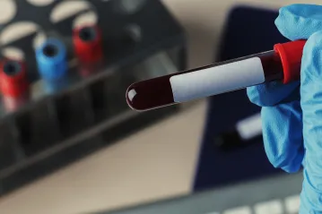 Blood Bank - Compatibility Testing