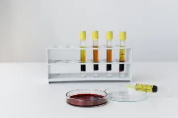 Coagulation Analyzer