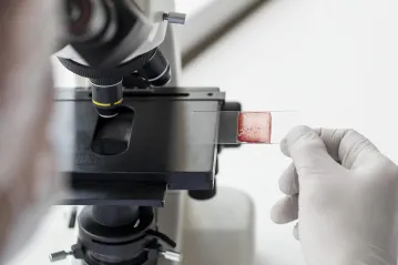 Tissue Processing