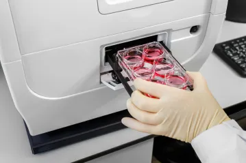 hematology gallery 1